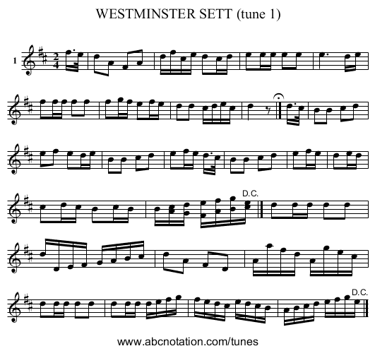 WESTMINSTER SETT (tune 1) - staff notation