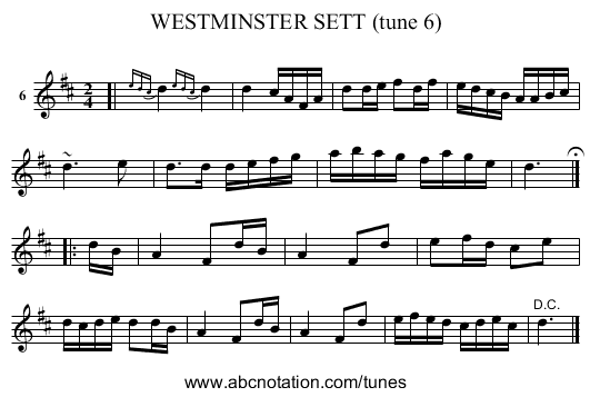 WESTMINSTER SETT (tune 6) - staff notation