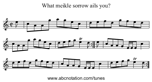 What meikle sorrow ails you? - staff notation