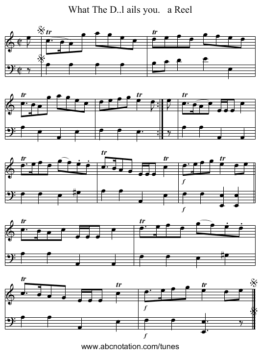 What The D..l ails you.   a Reel - staff notation