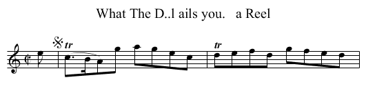 What The D..l ails you.   a Reel - staff notation