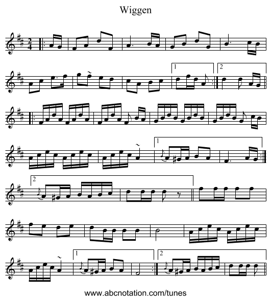 Wiggen - staff notation