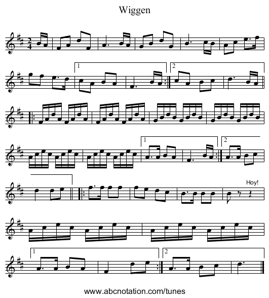Wiggen - staff notation