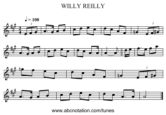 WILLY REILLY - staff notation