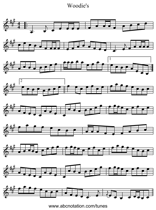 Woodie's - staff notation