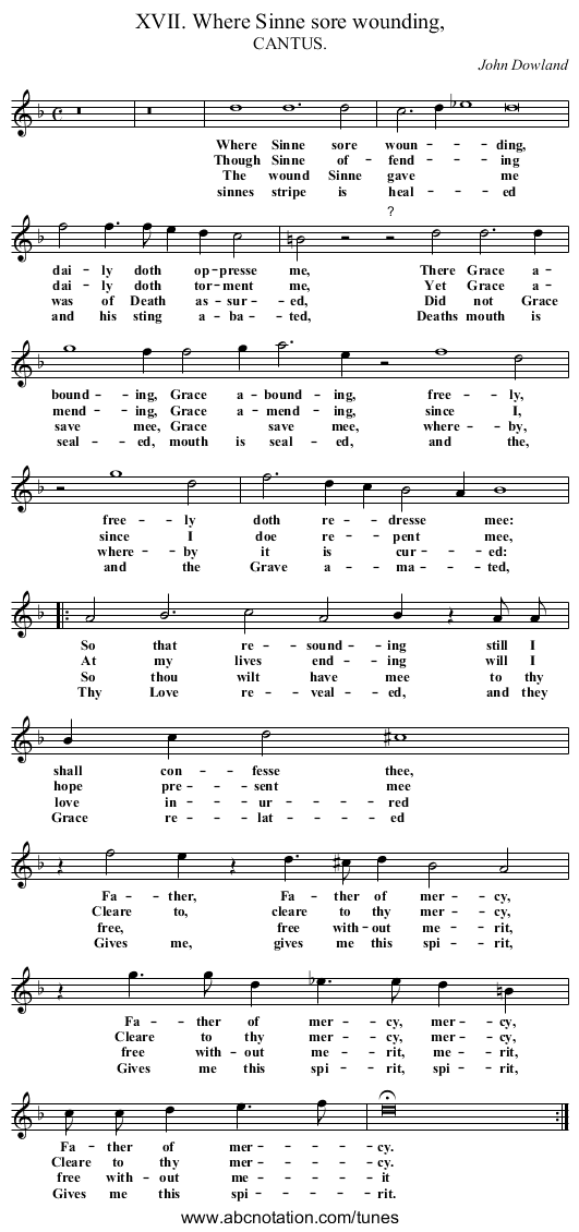 XVII. Where Sinne sore wounding, - staff notation