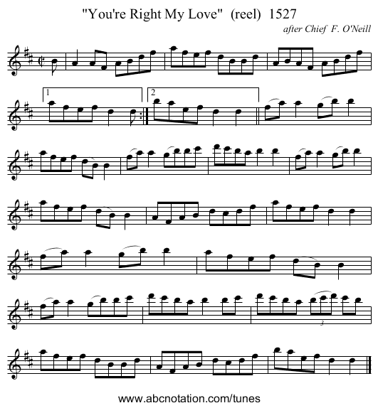 You're Right My Love  (reel)  1527 - staff notation
