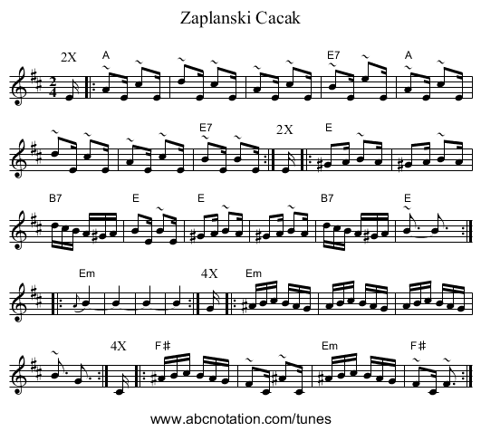 Zaplanski Cacak - staff notation