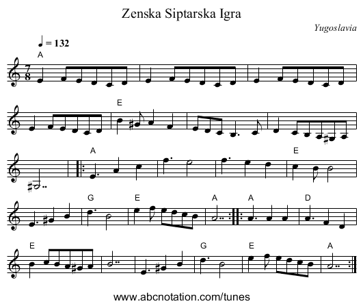 Zenska Siptarska Igra - staff notation